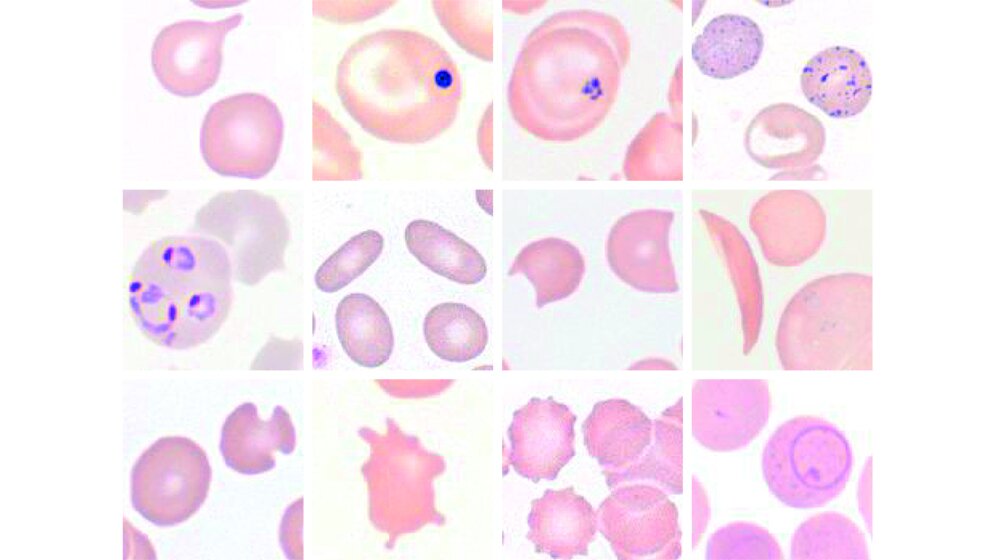 Formen und Einschlüsse