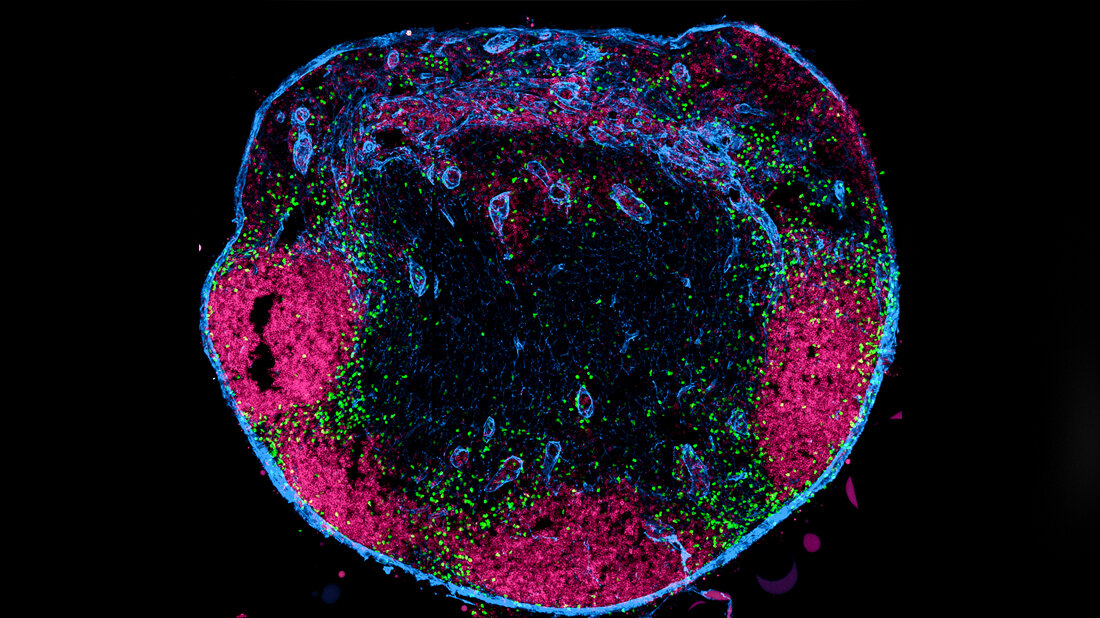 Querschnitt durch einen Lymphknoten. 