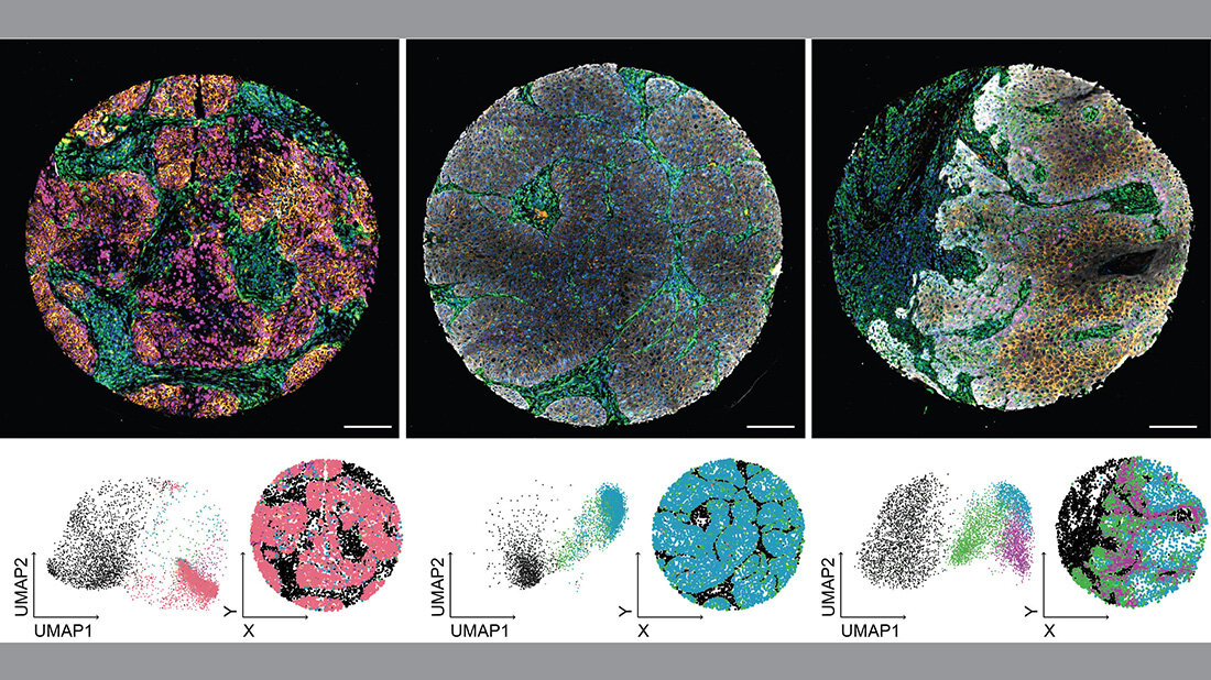 Tumordiagnostik.jpg Tumordiagnostik