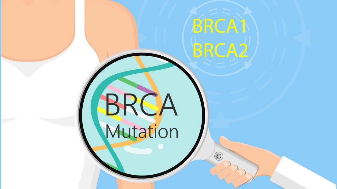 BRCA und Krebs
