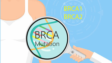 BRCA und Krebs