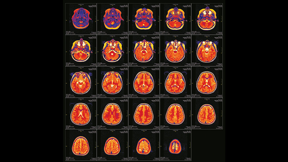 Neurologie