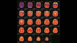 Neurologie