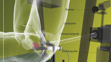 Aus der Forschung Brachytherapie