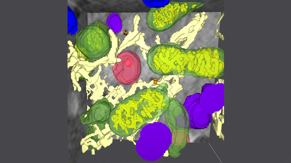 Kombination_der_einzelnen_Aufnahmen_zu_einem_3D_Bild_der_Zellarchitektur_Burcu_Kepsutlu_HZB.jpg Kombination der einzelnen Aufnahmen zu einem 3D-Bild der Zellarchitektur