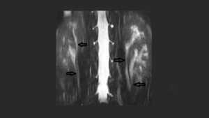 Anomalien und Normvarianten – Interne Veränderungen 2.11