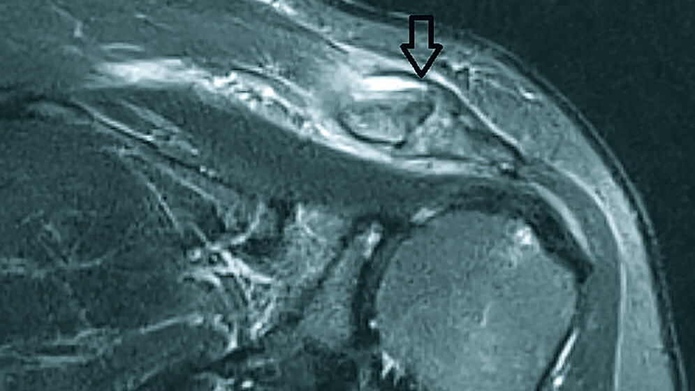 Anomalien und Normvarianten