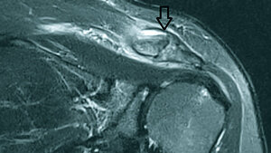 Anomalien und Normvarianten