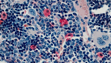 Blutbildende Zellen des Knochenmarks.