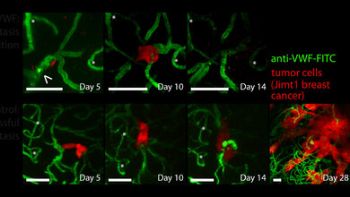 Blockade Gerinnungsfaktoren 