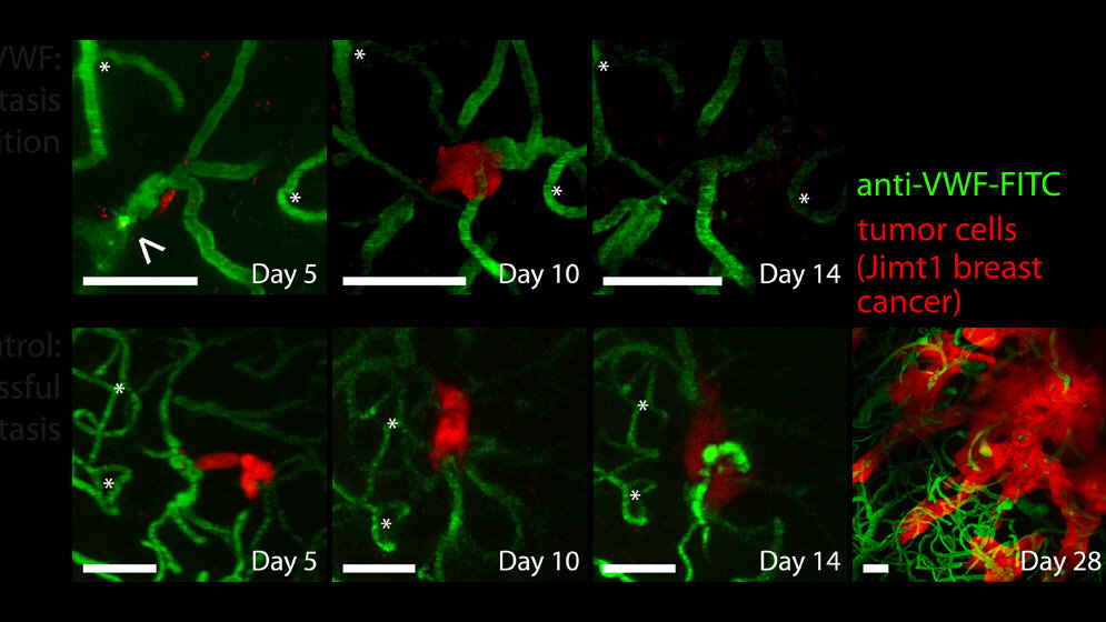 Blockade Gerinnungsfaktoren 