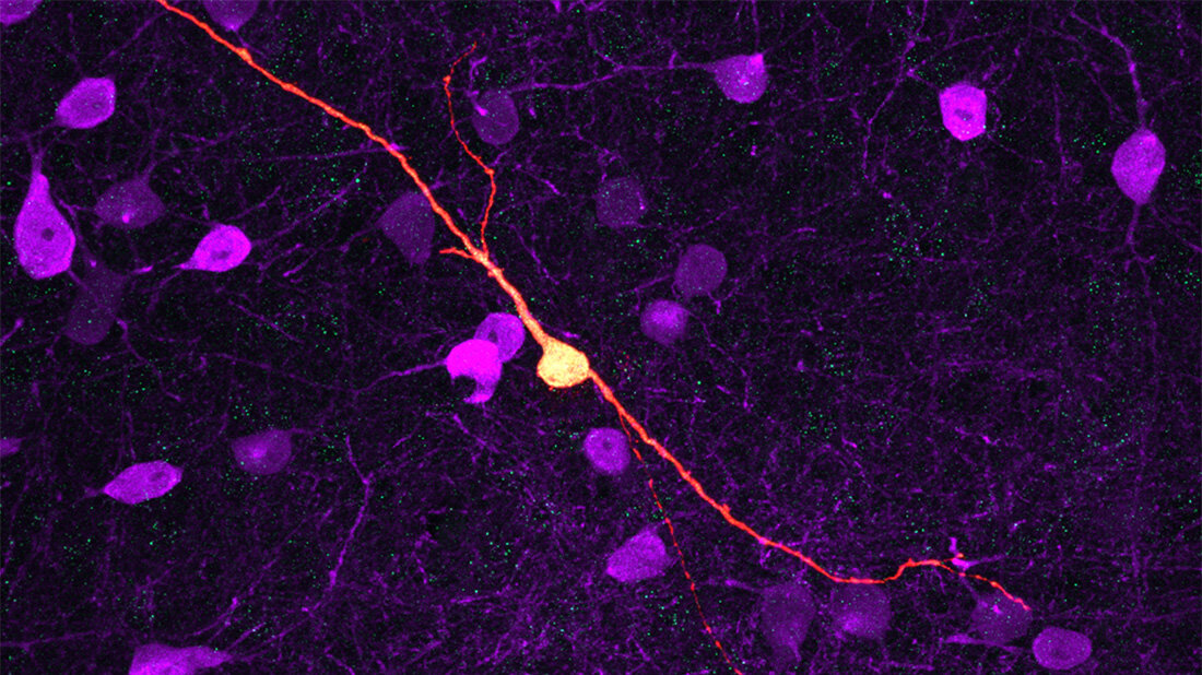 Gliazelle.jpg Gliazelle