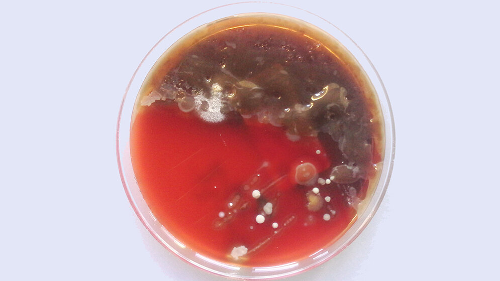 Pseudomonas aeruginosa