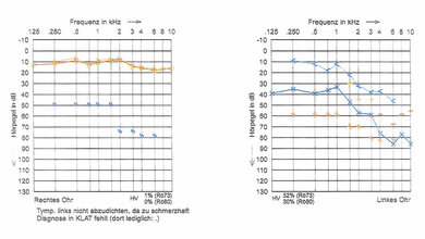Neurologie Komplikation einer Mittelohrentzündung: Hirnabszess