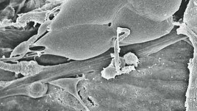 Aus der Forschung Latrophilin/CIRL