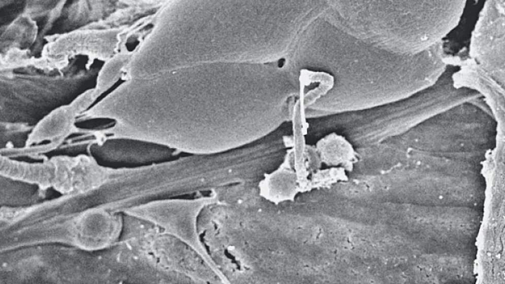 Aus der Forschung Latrophilin/CIRL