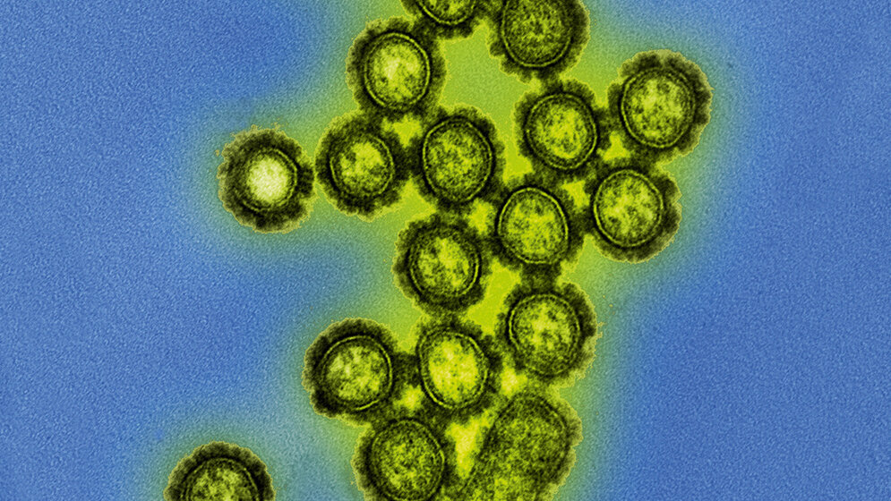 Vor 100 Jahren forderte die Spanische Grippe Millionen Tote