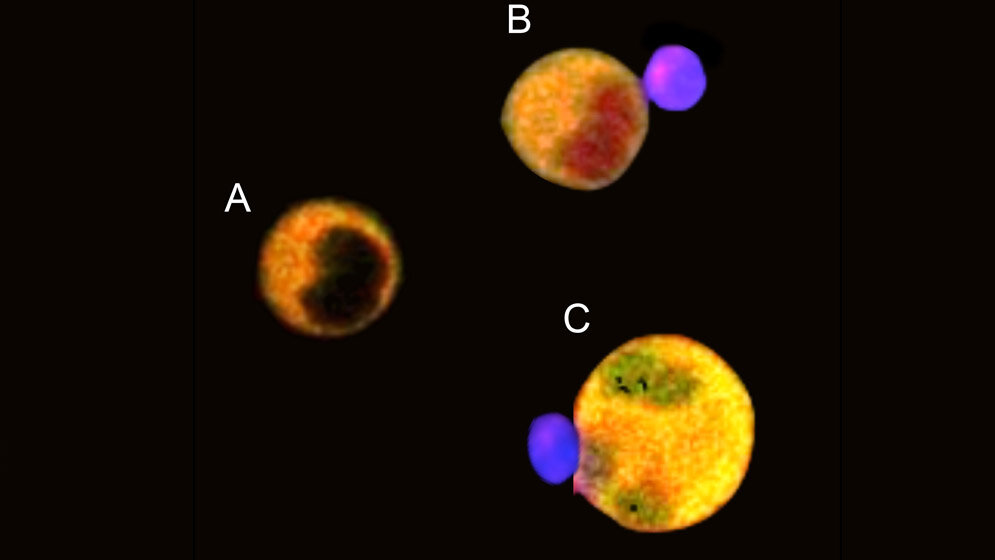 Tumorzellen mit Fluoreszenzmarker