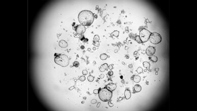 Funktion der Killer-T-Zellen