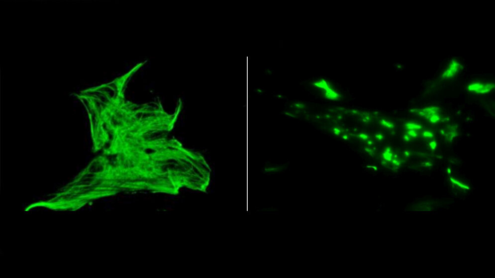 komplexes Skelett im Inneren verbindet Zellen