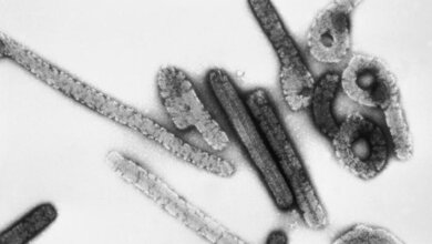 Marburg_Virus_Photo_Credit_CDC__Dr_Erskine_Palmer_Russell_Regnery_Ph_D_public_domain.jpg Marburg Virus