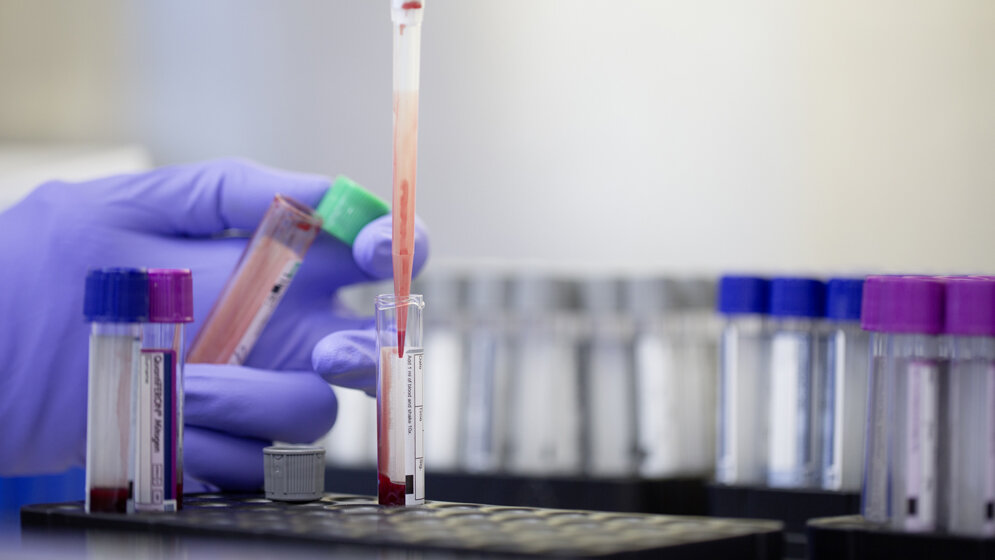 QuantiFERON_TB_Bluttest_obs_Qiagen_N_V_QIAGEN.jpg QuantiFERON-TB Bluttest