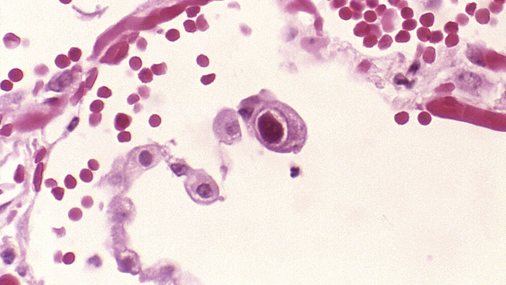Mikrobiologie