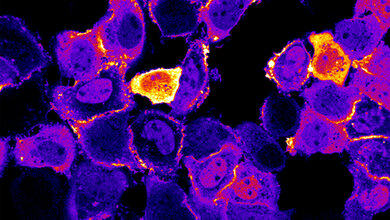 Photoschaltbare Fettsäuren 