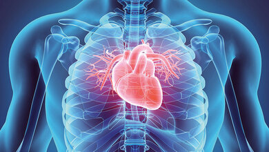 Kardiologie Myokarditis