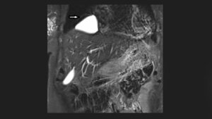 Titelbild zum Fachbeitrag aus der Reihe „Anomalien und ‧Normvarianten: Interne Veränderungen“ zur Perikardzyste