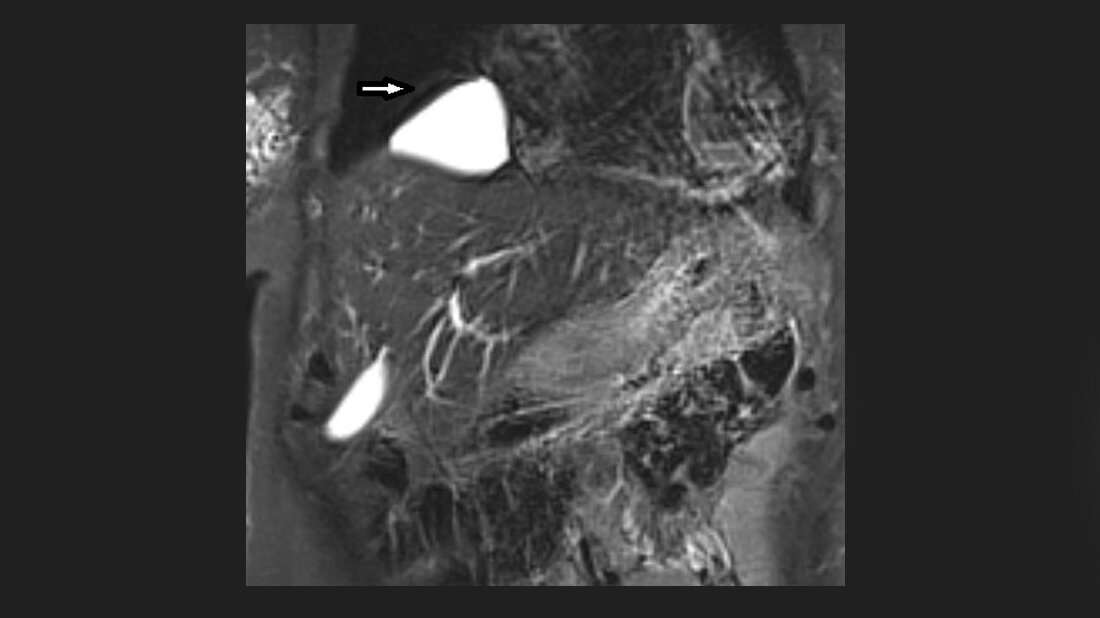 Titelbild zum Fachbeitrag aus der Reihe „Anomalien und ‧Normvarianten: Interne Veränderungen“ zur Perikardzyste