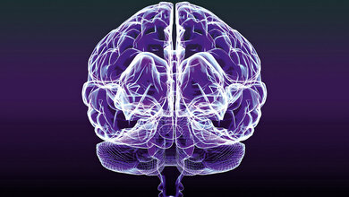 Demenzdiagnostik in der Nuklearmedizin Titelbild des Fachbeitrags zur Demenzdiagnostik in der Nuklearmedizin