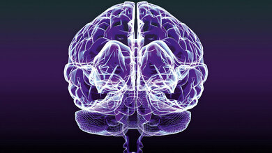 Titelbild des Fachbeitrags zur Demenzdiagnostik in der Nuklearmedizin