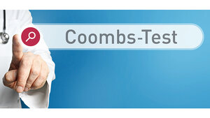 Grafik mit Namen des Tests