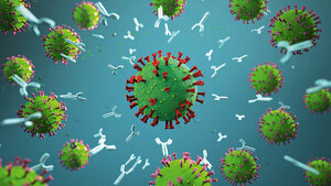SARS-CoV-2 Antibody Detection