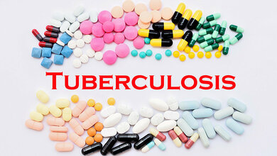 Antibiotikaresistenzen erschweren die Tuberkulose-Therapie.