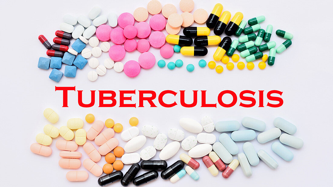 Antibiotikaresistenzen erschweren die Tuberkulose-Therapie.