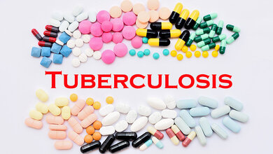 Tuberkulosebehandlung_am_Limit.jpg Antibiotikaresistenzen erschweren die Tuberkulose-Therapie.