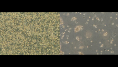 Links abgebildet die intakte Wirtszellen (NCTC) vor Viruskontakt (100-fach vergrößert), rechts abgebildet zytopathischer Effekt an Wirtszellen durch Viren (100-fach vergrößert).