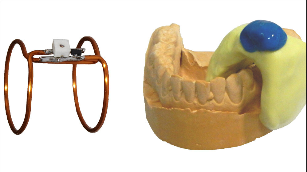 präzisere MRT-Bilder 