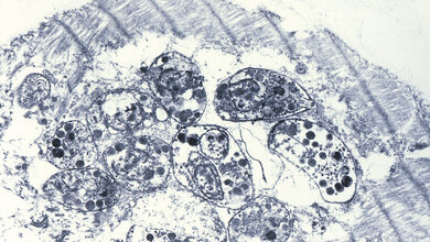 Mikrobiologie Toxoplasmose