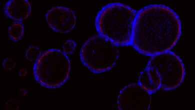 Fluoreszenzmikroskopische Aufnahme von mehreren Organoiden