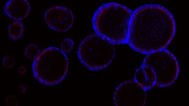 Fluoreszenzmikroskopische Aufnahme von mehreren Organoiden