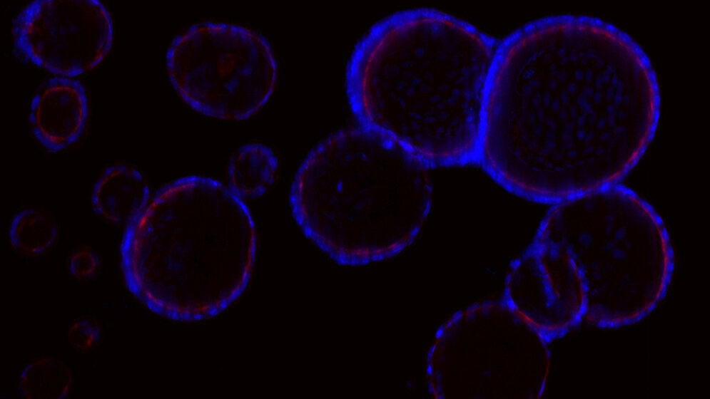 Fluoreszenzmikroskopische Aufnahme von mehreren Organoiden