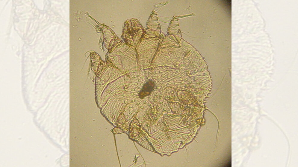 Sarcoptesmilbe 