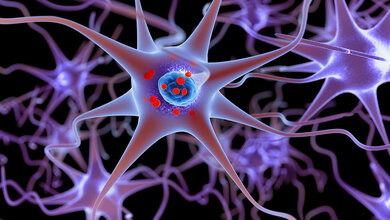 Gemeinsames Schlüsselprotein für Morbus Parkinson und Dystonie
