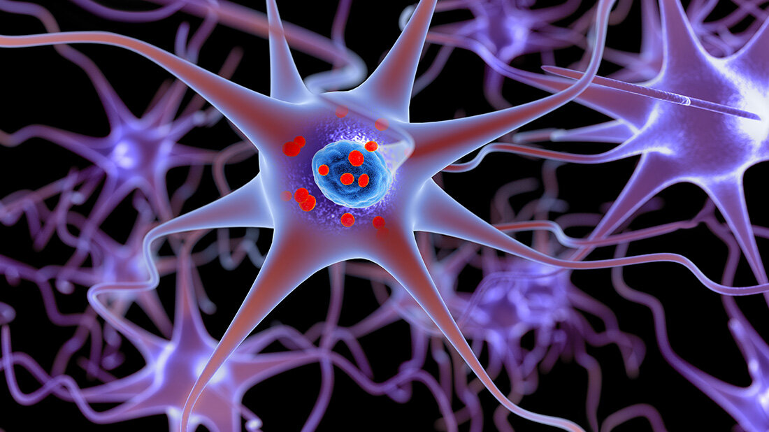 Schluesselprotein_Parkinson.jpg Gemeinsames Schlüsselprotein für Morbus Parkinson und Dystonie