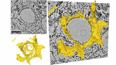 Schnitte durch das dreidimensionale Rekonstruktionsvolumen
