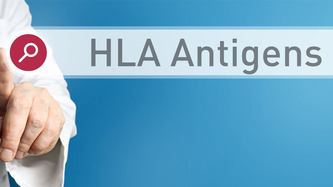 HLA.jpg HLA.jpg