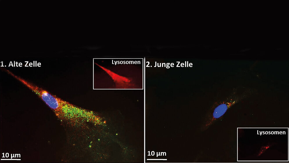 Das Alter beeinträchtigt zelluläre Müllabfuhr